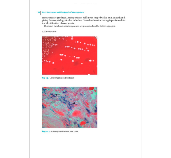 Atlas of Clinically Important Fungi