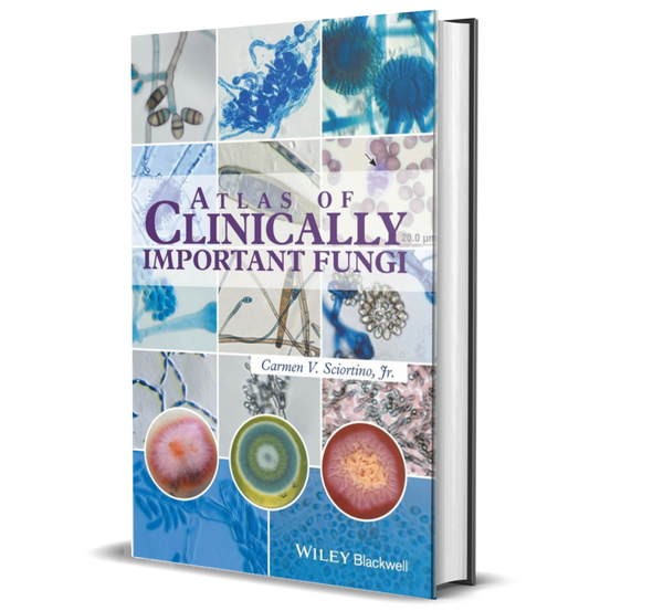 Atlas of Clinically Important Fungi